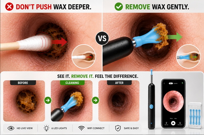A promotional comparison graphic for a handheld wax-removal device. The top half shows two close-up views of an anal or glandular opening: the left demonstrates pushing wax deeper with a cotton swab, marked with a red X, and the right demonstrates gentle removal with the blue-and-black device, marked with a green check.